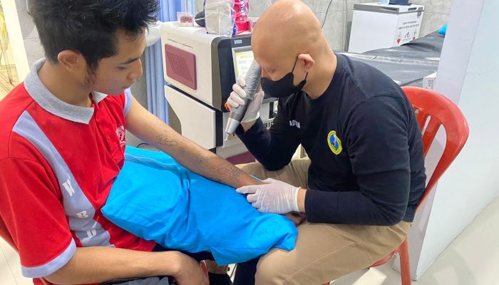 Hapus Tatto, Disambut Antusias Puluhan Warga Lapas Kelas II B Bondowoso