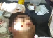 Niat Menonton Singo Ulung, Pengunjung Wisata Pemandian Tasnan Bondowoso Alami Luka Robek